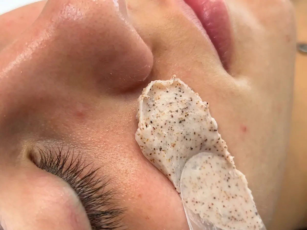 Esfoliação durante limpeza de pele na Q!Clinic