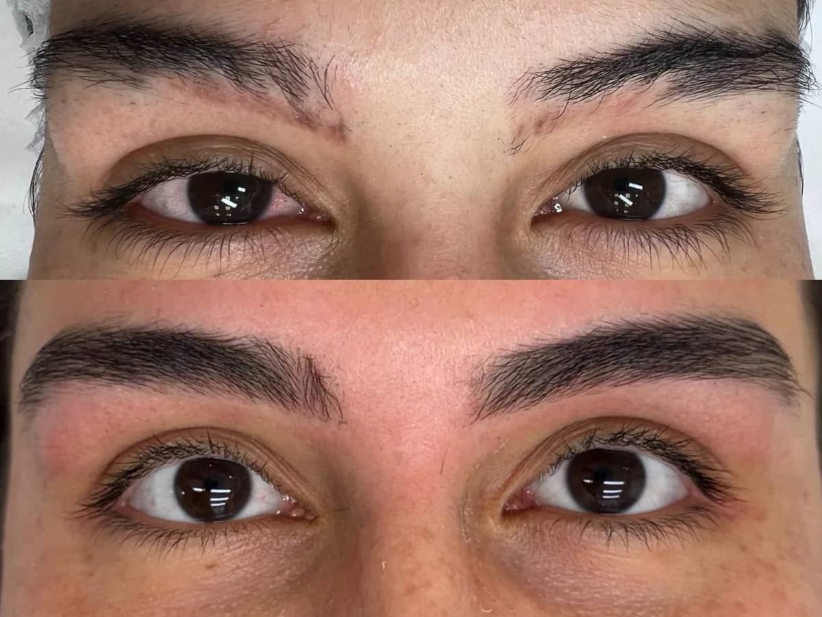 Comparação de dois momentos das sobrancelhas de uma mulher, antes e depois do protocolo Q!Repair