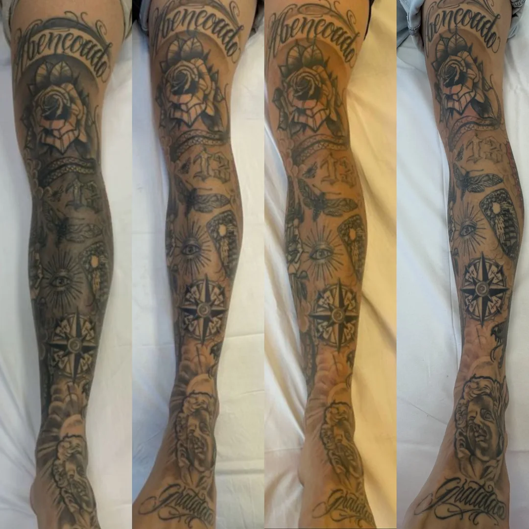 Antes e depois de remoção de tatuagem a laser em braço inteiro, três momentos do protocolo